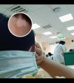白点癫风去哪家医院治疗