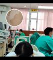 他克莫司正常血浓度是多少
