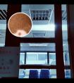 皮肤ct检查出有很多白斑什么原因引起的