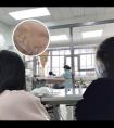 小儿颈部白斑是什么原因导致的怎么治疗