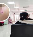 晕痣怎么治疗最好最快的方法图片女性