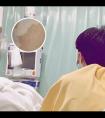 医用308激光治疗仪怎么用