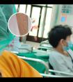 308激光治疗视频
