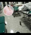 希格玛308光疗仪使用方法视频